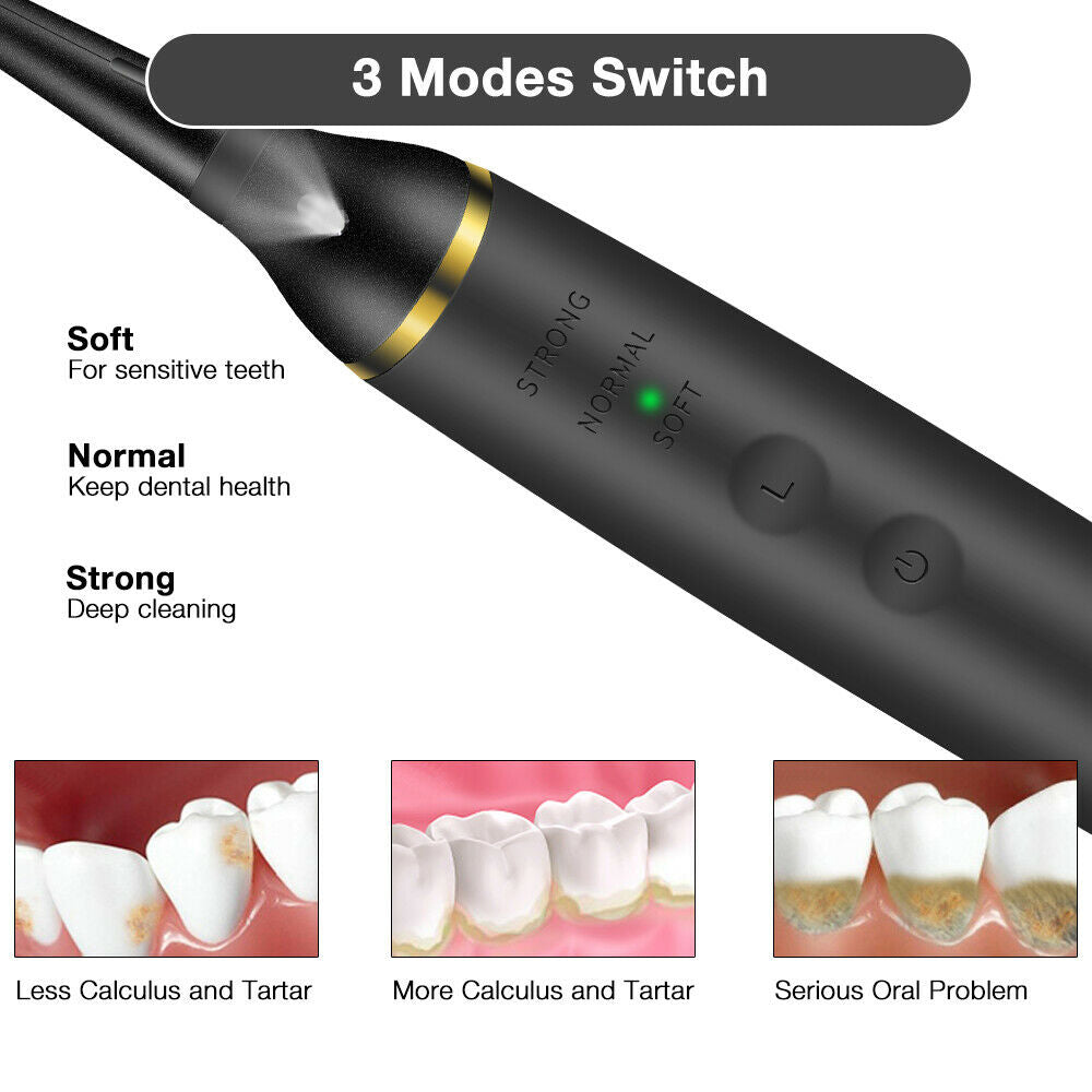 Professional Electric Teeth Cleaner Teeth Tartar Stains Remover- USB Charging_5